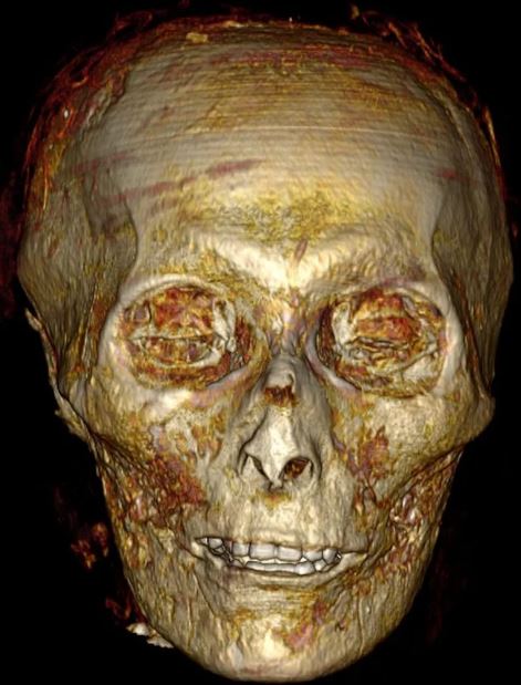 El cráneo de Amenhotep I en tomografía computada.