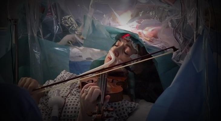 VIDEO: toca el violín mientras le extirpan un tumor cerebral-0
